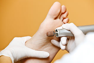 medische pedicure ingegroeide nagels nagelbeugel nagels chiropodiste schimmelnagel diabetische voet oncologische voet eelt wratjes likdoorn