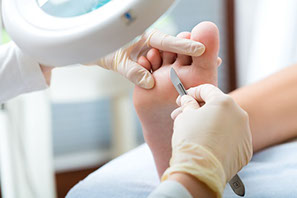 medische pedicure ingegroeide nagels nagelbeugel nagels chiropodiste schimmelnagel diabetische voet oncologische voet eelt wratjes likdoorn